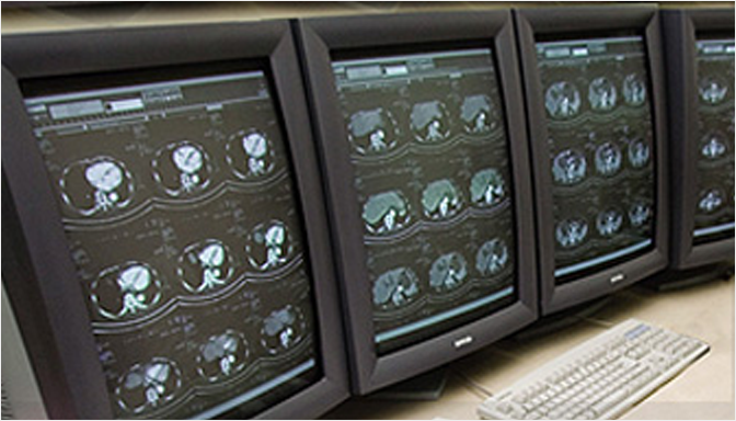 영상저장전송시스템 PACS